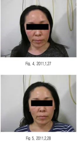 Fig.  1.  2010.12.13 Fig.  2.  2011.2.14 Fig.  3.  2011.4.4 Fig.  4.  2011.1.27Fig  5
