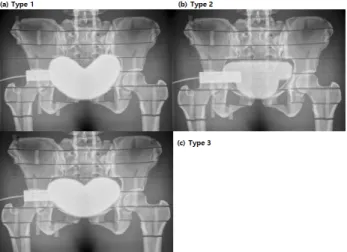 Fig.  3.  The  image  of  ovarian  shielding  in  female  rando  phantom  using  three  different  shielding  materials