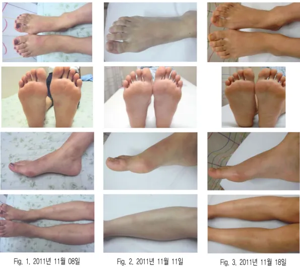 Fig.  1.  2011년  11월  08일 Fig.  2.  2011년  11월  11일 Fig.  3.  2011년  11월  18일