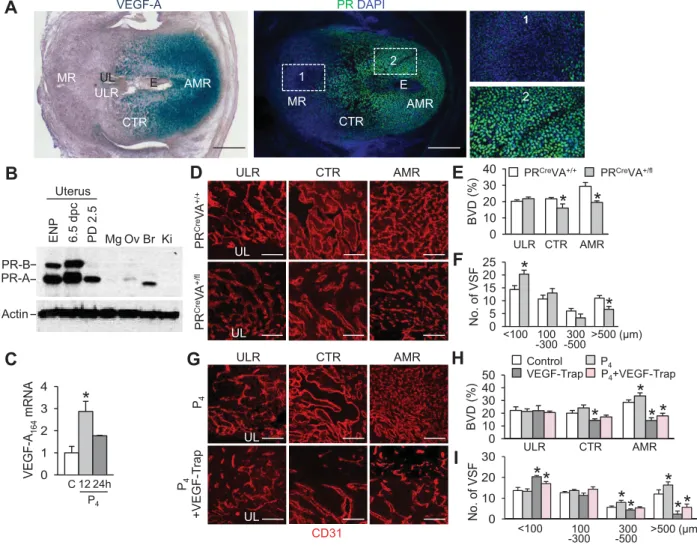 Figure 4. P4 ‐PR axis positively regulates VEGF‐A expression in DSCs for decidual angiogenesis and EEVSF.