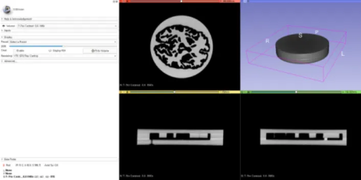 Fig.  2.  The  DICOM  file  was  converted  to  STL  format  using 3D  slider