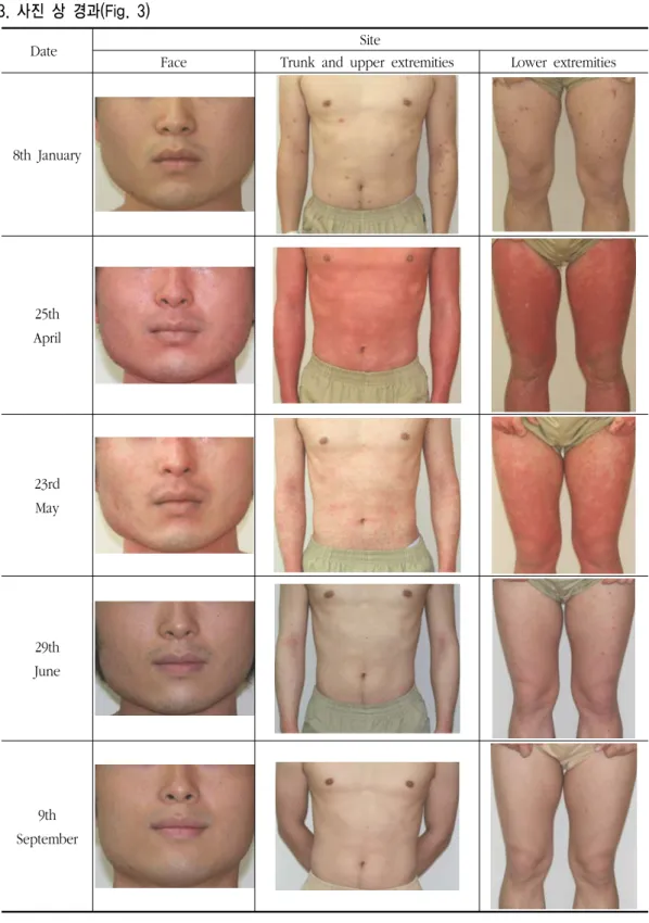 Fig.  3.  Pictures  of  lesion     3.  사진  상  경과(Fig.  3)