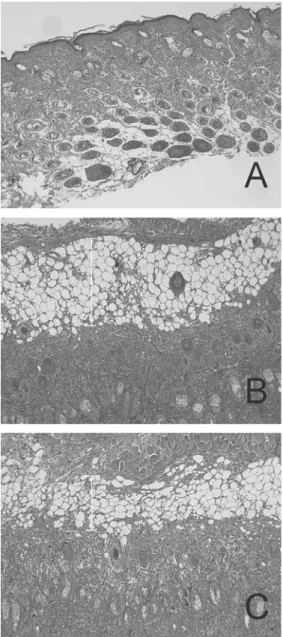 Fig.  4.  Effects  of  SR  on  histopathological  observation  in  ACD  tissue 