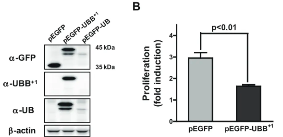 Figure 1. Ectopic expression of UBB +1 in human astrocytic cell. (A) CRT-MG cells were stably transfected with pEGFP, pEGFP-UBB +1 or pEGFP- pEGFP-UB constructs