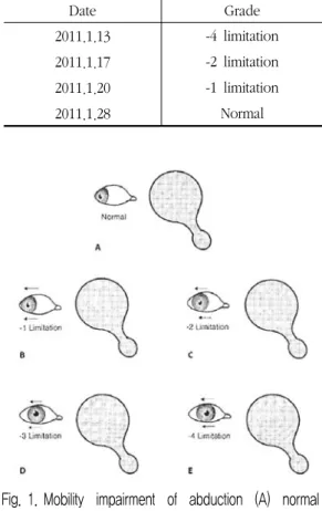 Table  2.  Mobility  Impairment  of  Abduction