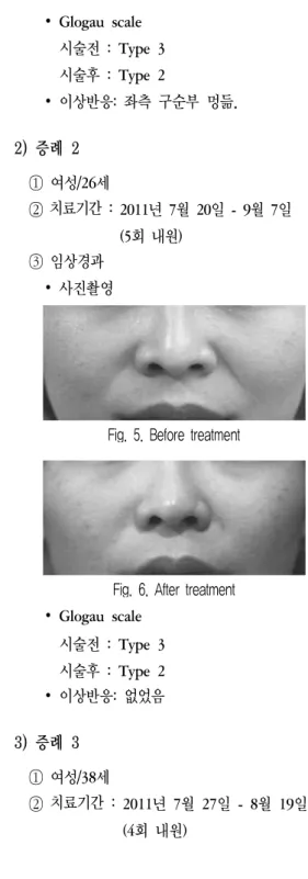 Fig.  4.  After  treatment