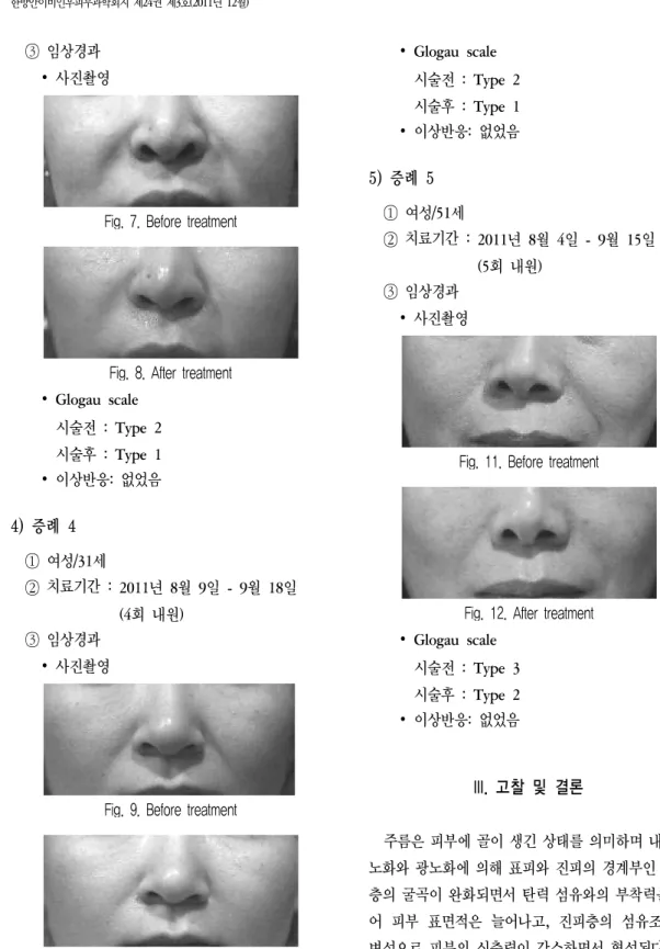Fig.  7.  Before  treatment        