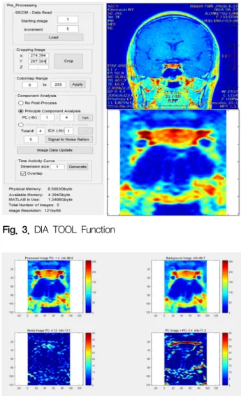 Fig. 3은 DIA TOOL의 기능으로 DICOM-Data Read,  Cropping image, Colormap Range, Component Analysis,  Time Activity Curve (TAC)로 구성되어 있다