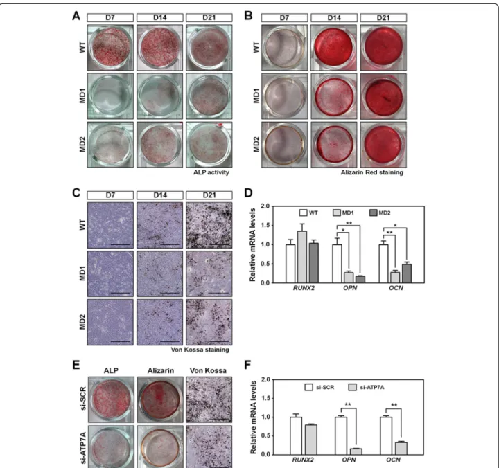 Fig. 4 Impaired osteogenesis in MD-MSCs. a Representative images of ALP activity in WT- and MD-MSCs during OB differentiation