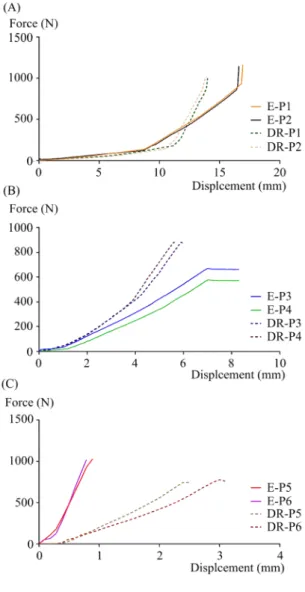 Fig.  7.  The  responses  of  prosthesis  against  small  obstacle  placed  in  different  locations