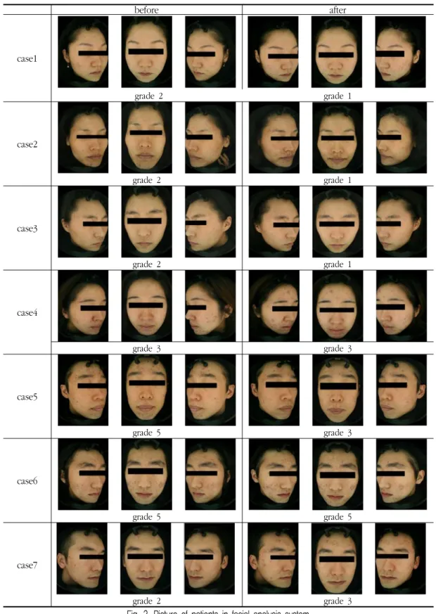 Fig.  2.  Picture  of  patients  in  facial  analysis  system