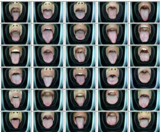 그림 7. 혀 영역의 영상 Fig.  7.  Image  of  tongue  area
