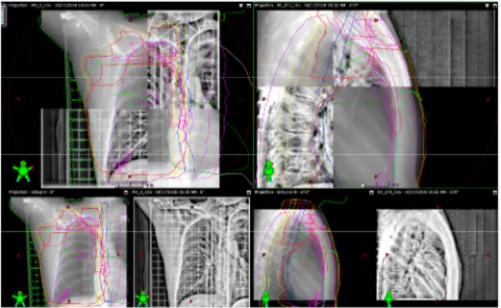Fig. 1. 2D-2D matching using reference image and acquisition  image   