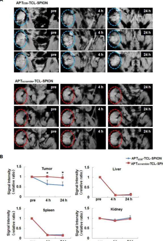 Figure 5. In vivo EDB-FN targeted tumor MRI. (A) T 2 *-weighted multi-slice images of the NDY-1 tumor in the mouse obtained prior to injection and at 4 h and 24 h after 