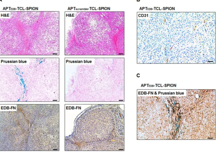 Figure 6. Histological analysis of the tumors. (A) Hematoxylin and eosin (H&amp;E) staining, Prussian blue staining and EDB-FN immunostaining