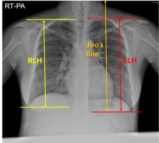 Fig.  1  Measurement  method  of  image