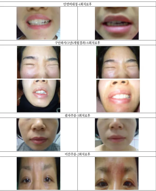 Fig. 1. Before/After the Treatment.