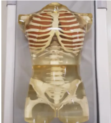 Fig.  2  Axial  section  view  of  human  phantom  for  calcium  score.  The  yellow  color  portion  indicates  above  140  CT  number