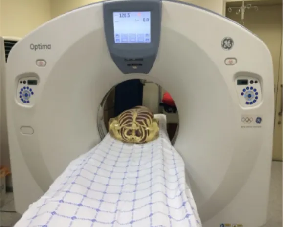 Table  1  Parameter  used  in  anthropomorphic  phantom  CT  scan Scan  Parameter Detector  Coverage 40  mm Thickness,  Interval 5.0  /  2.5  mm kVp 120  /  100 mA60