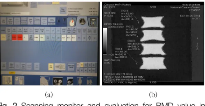 Fig.  2  Scanning  monitor  and  evaluation  for  BMD  value  in  DECT  scanner