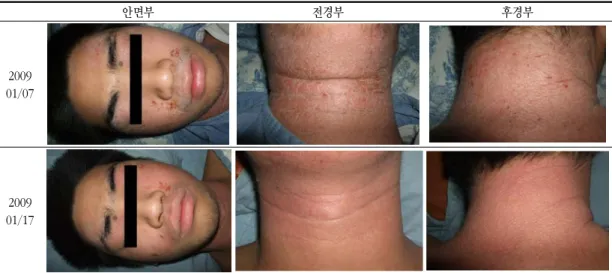 Fig. 15. Pictures of lesion - Case 3. 