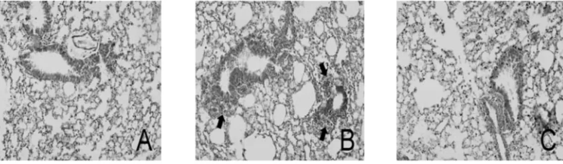 Fig. 14. Effects of CLR on histopathological changes of the lung tissue in asthmatic mice
