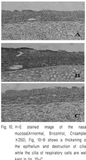 Fig. 9. Changes  of  ALT.  Values  represent  the  mean±S.D. 9. 비점막의 형태학적 소견     비점막을  H-E  염색하여  관찰한  결과,  정상군 (Fig