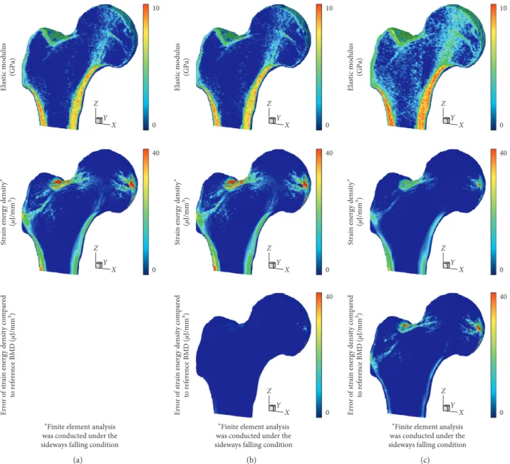 Figure 4: Distribution of elastic modulus, strain energy density, and error of strain energy density in the proximal femur: (a) case of using