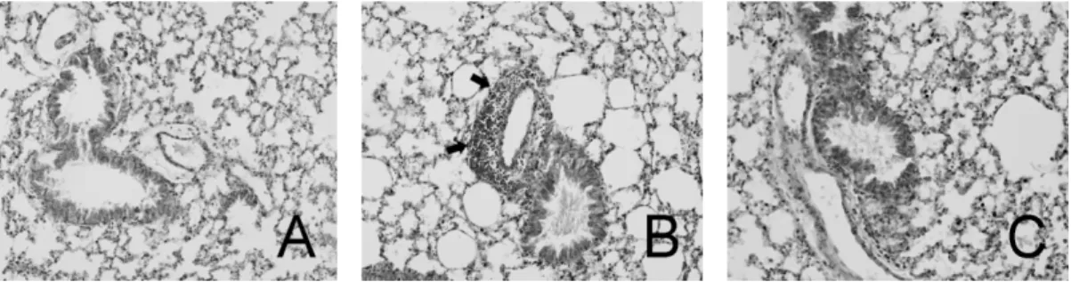Fig. 16. Effects of PR on histopathological changes of the lung tissue in astmatic mice