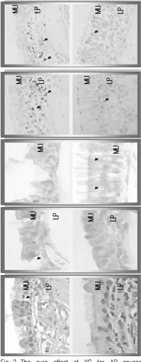 Table 3. The  Image  Analysis  of  ZO-1,  MIP-2  and  COX-2  Positive  Reaction  in  YT  after  Allergic Rhinitis(AR) Elicitation.