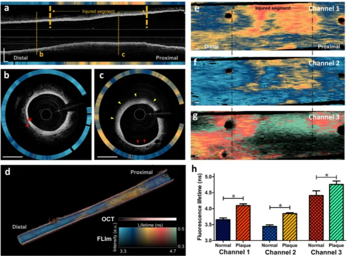 Figure 4.  In vivo OCT/FLIm imaging results in a rabbit aorta. (a) Longitudinal OCT/FLIm images of a rabbit 