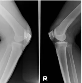 Figure  15  Slit-filed  error  Artifact  -  CR