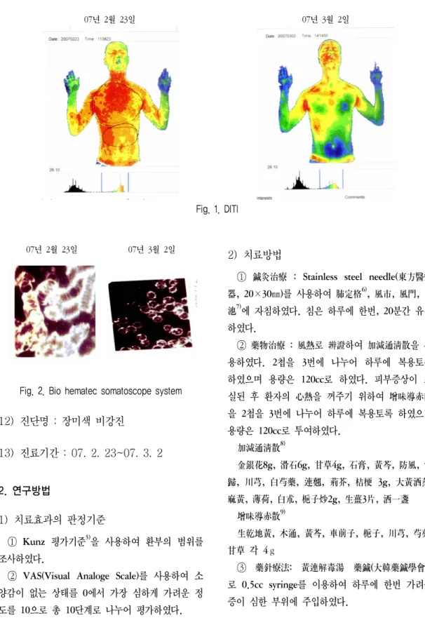 Fig. 2. Bio hematec somatoscope system 12)  진단명  :  장미색  비강진 13)  진료기간  :  07.  2.  23~07