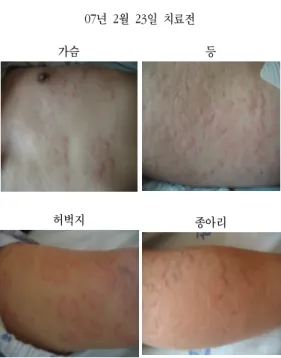 Fig. 5. After Treatment 2day