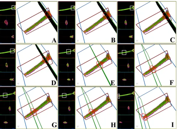 Figure 7.  3D RI tomograms of a sperm midpiece based on RI-I, RI-II, and RI-III. (A) to (I) Cross-sectional  images of the RI tomogram of a representative sperm at various positions inside the midpiece