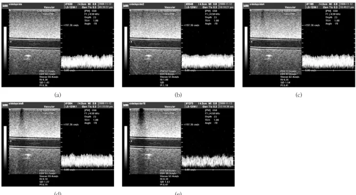 Figure  3  Examples  of  the  Doppler  images  obtained  using  the  probe  with  a  set  of  adjacent  elements  (1 ,  2,  4,  8,  6)  simultaneously  disconnected  (SAESD)  moving  from  the  left  to  the  right