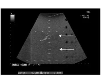 Fig.  5  Axial  and  lateral  resolution