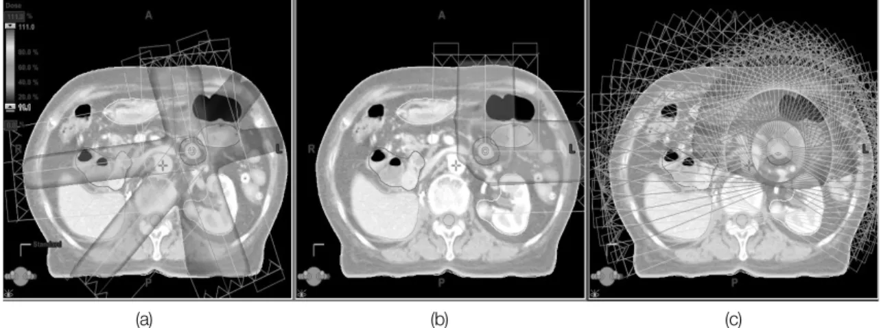 Fig.  1  Each  plan  method  dose  distribution  (a:  IMRT,  b:  PBT,  c:  PAT)(a)(b) (c)Ⅰ