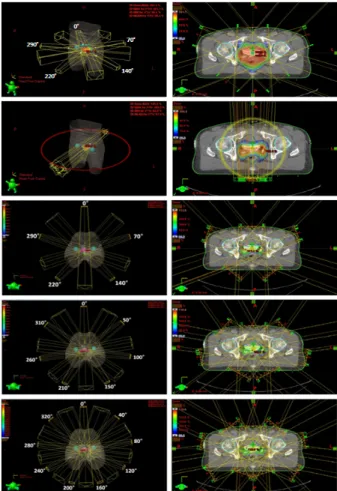 Figure 1. 3D CRT, Arc, and Portal to the 5, 7, and 9portal for IMRT variables in the direction of the beam angle