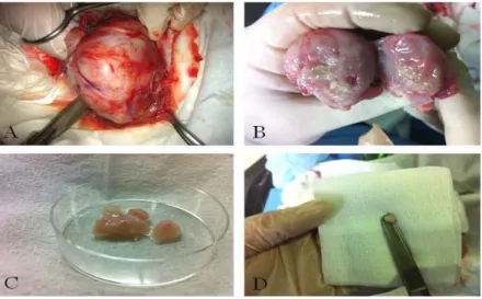 Figure  1  VX2  tumor  removal  from  the  host  rabbit 