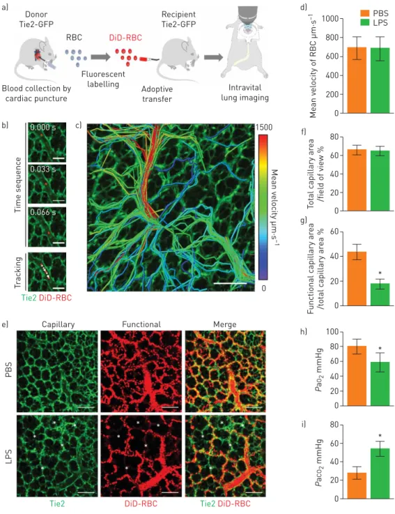 FIGURE 1 Impaired pulmonary microcirculation in sepsis-induced acute lung injury revealed by the functional capillary ratio