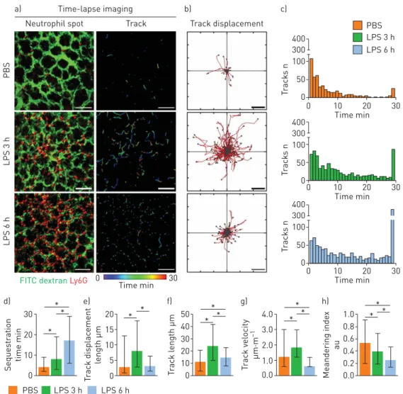 FIGURE 3 Increased entrapment time and dynamically altered motility of neutrophils during the development of sepsis-induced acute lung injury