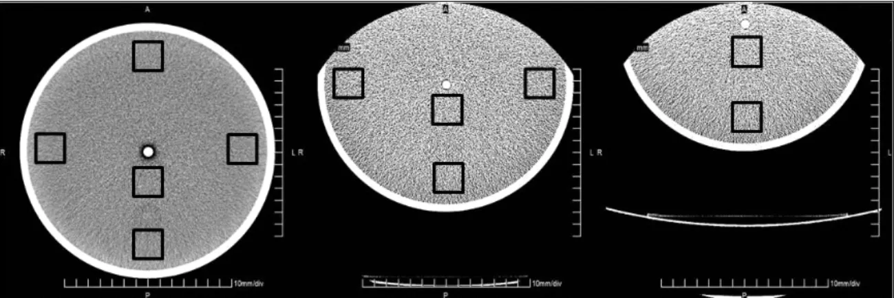 Figure  4.  CTDIw  with  various  beam  collimation  at  each  position  for  the  air  scan  study(left;  head  parts,  right;  body  parts)Figure  3