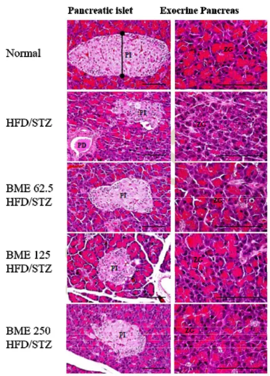 Fig. 2. The representative histopathological profiles of the pancreas – splenic lobe tissues, taken from Normal or HFD/STZ  rats.