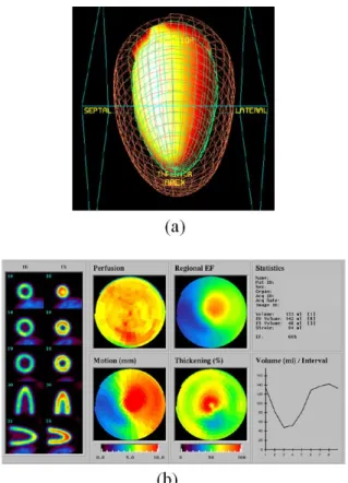Fig. 11. The example of the result of QGS analysis was  shown with 3-D surface(a) and results of motion analysis(b).