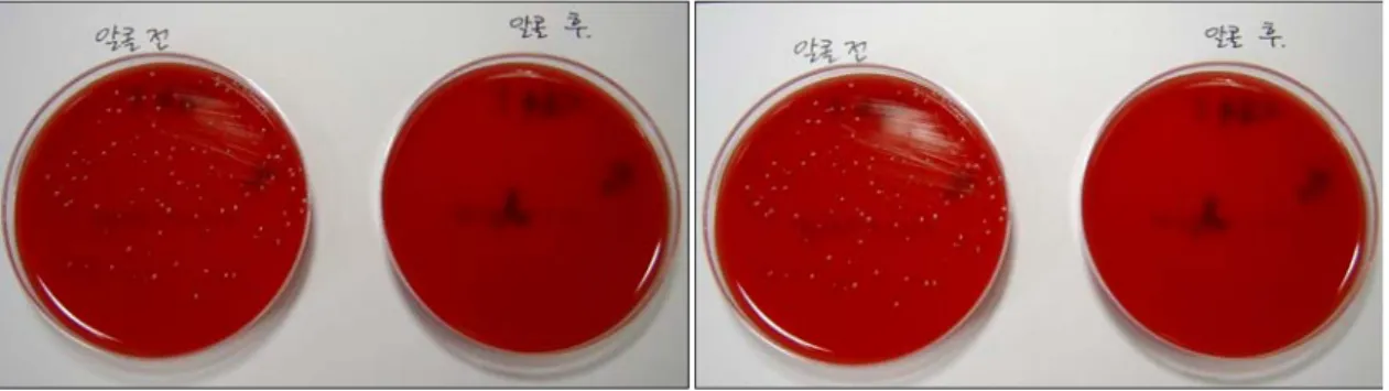 Fig.  2.  IP  카세트와  테이블의  70%  알코올  소독  전 ․ 후  배양된  균의  모습