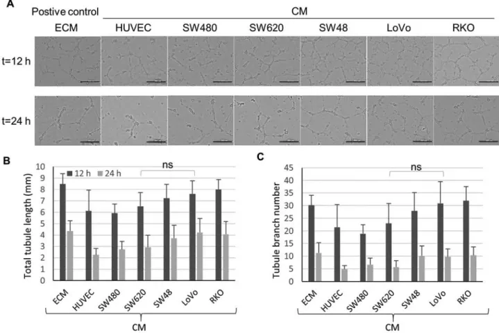 Fig. 1C). ANOVA demonstrated that the migrated cell changed  area was significantly higher in cells treated with LoVo‑CM  compared with SW620‑CM (Fig