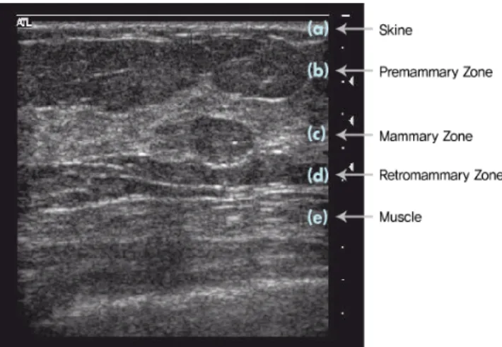 Fig.  1.  Image  of  normal  breast  using  ultrasound