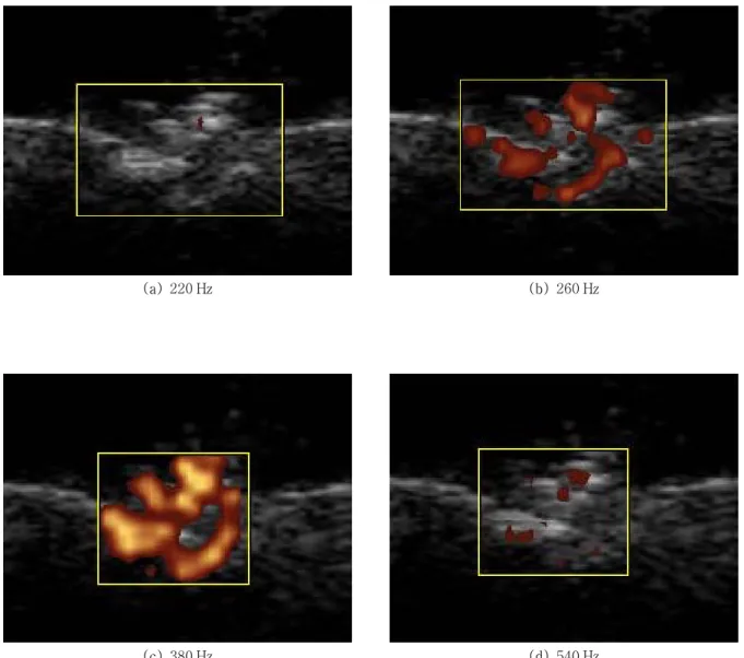 Fig.  5.  Images  of  calcification  for  sample  5  in  gelatin  phantom