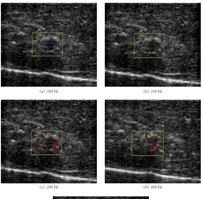 Fig.  9.  Images  of  calcification  in  sow  breast  phantom